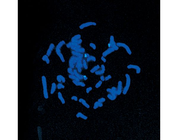 VECTASHIELD? Antifade Mounting Medium with DAPI