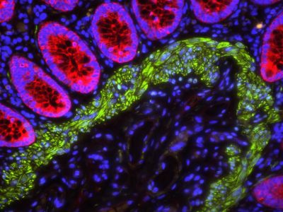 VECTASHIELD? Antifade Mounting Medium with DAPI