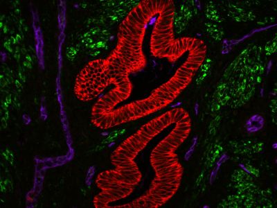 VECTASHIELD? Antifade Mounting Medium with DAPI